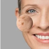 Janssen Dark Spot Perfector | Serums pigmentācijas plankumiem 30 ml