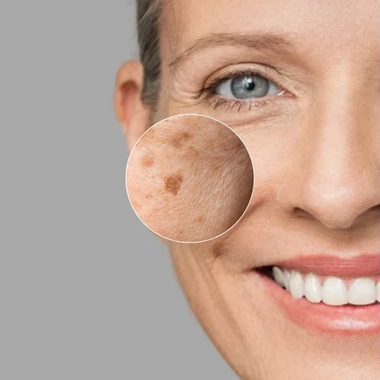 Janssen Dark Spot Perfector | Сыворотка от пигментных пятен 30 мл