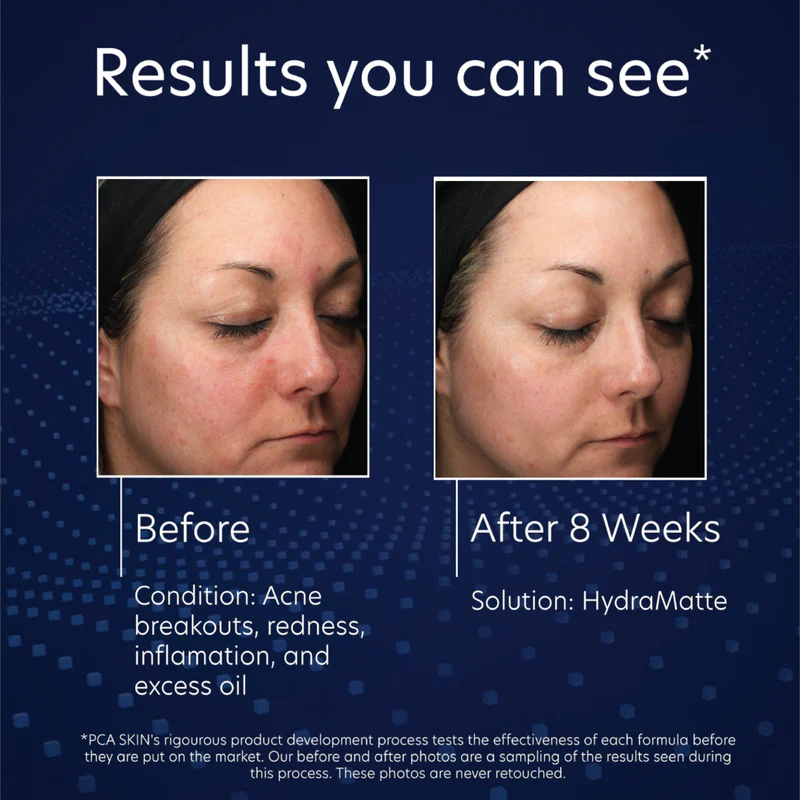 PCA Skin HydraMatte | Matējošs Krēms Taukainai Ādai 50 ml