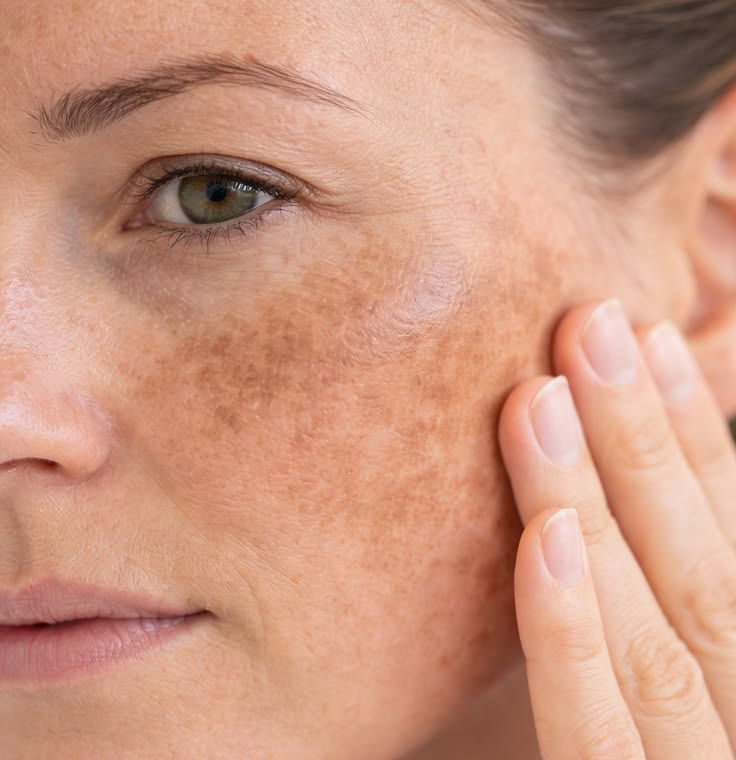 Skincare for pigmentation and uneven skin tone